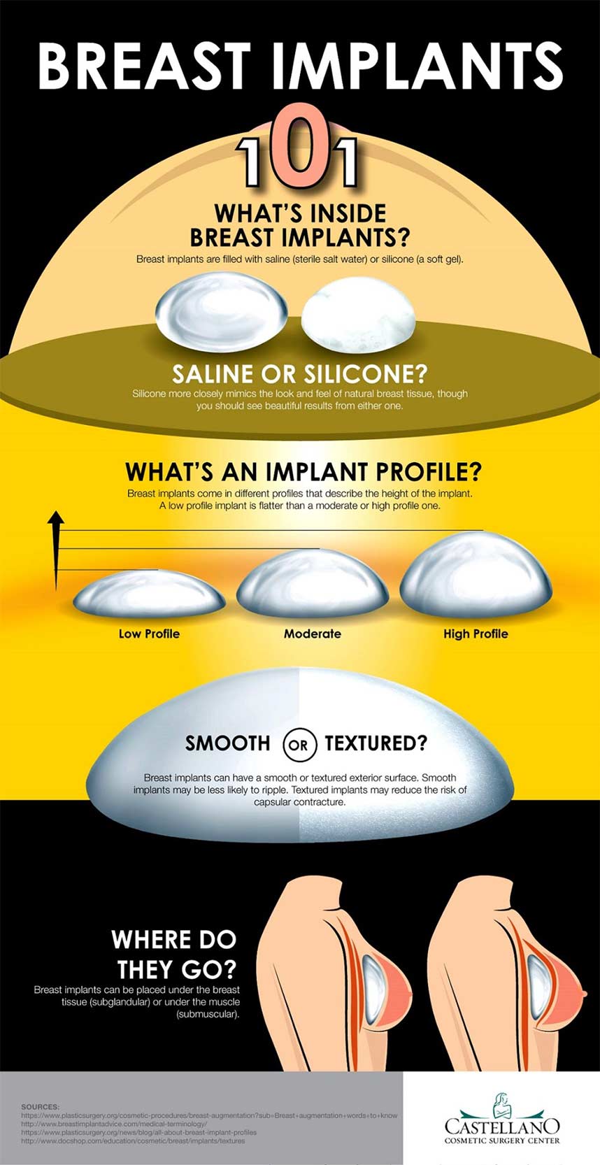 Breast Implant Sizing Explained [Infographic] - Martin Plastic Surgery